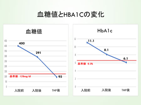 歯周病治療後の結果